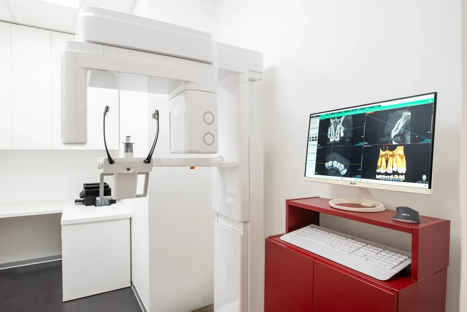 3D CBCT felvétel